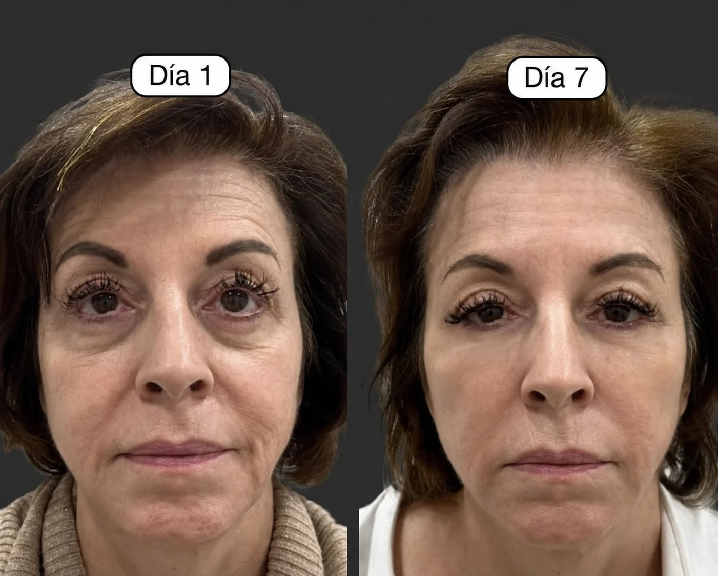 Cepillo Facial Para Contorno Linfatico