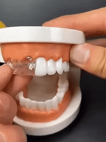 InstantSmile™ | Kit Premium Prótesis Dental Moldeable