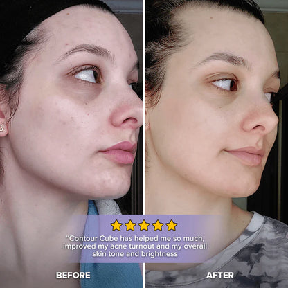 3X1 Masajeador Facial Hieloterapia - Deshincha y da brillo