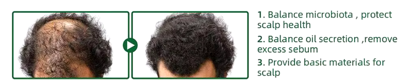OFERTA 2 unidades x $910 MXN