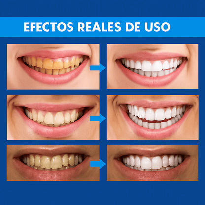 WhiteSmile™ - Lápiz Blanqueador Dental Instantáneo