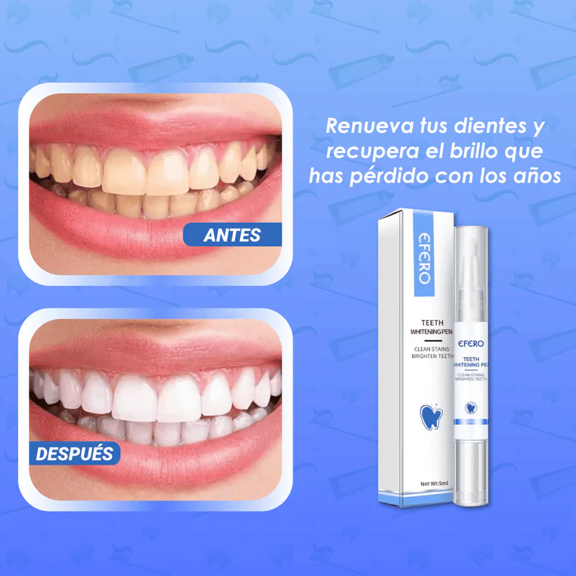 WhiteSmile™ - Lápiz Blanqueador Dental Instantáneo