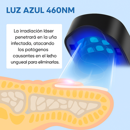 Dermolux™ | Tratamiento Antihongos Profesional En Casa 🦶💅